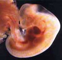 Ciąża biochemiczna / puste jajo